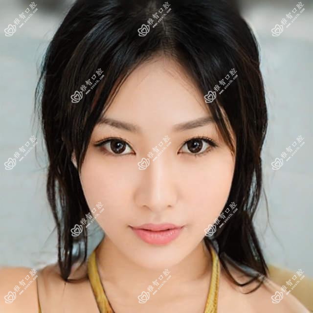 宁波半隐型矫正价目单总览,想变好看的朋友能够参照