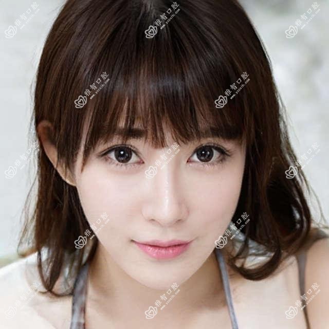 单颗牙种植需要注意什么?单颗牙种植好转方法详解?
