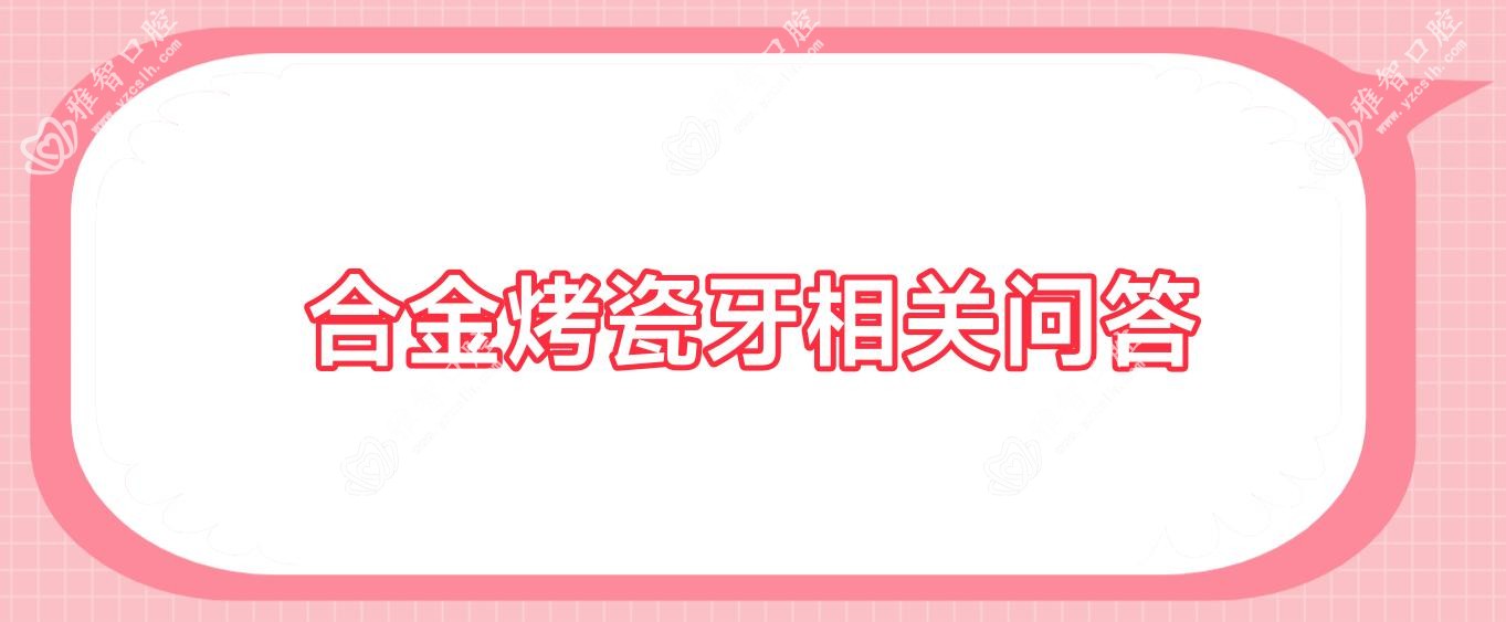 合金烤瓷牙相关问答
