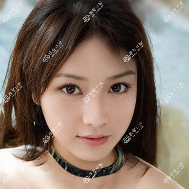 嘉兴韩国dio种植牙多少钱?嘉兴美国3I种植牙/美国百康种植牙/瑞典诺贝尔种植牙费用偏低