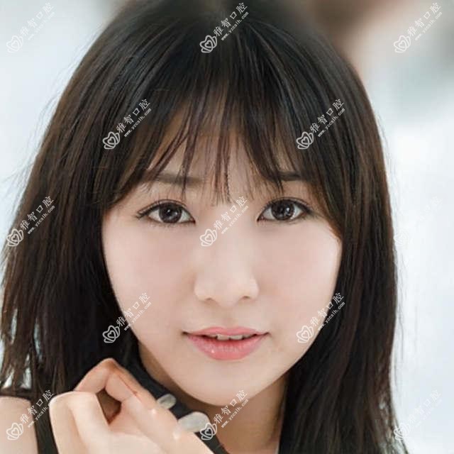 2025年武汉3m黄金incognito舌侧矫正价目单:3m黄金incognito舌侧矫正74658+3m黄金incognito舌侧矫正80000+3m黄金incognito舌侧矫正80000+ebrace舌侧矫正50000+