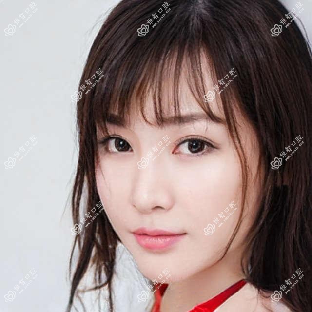青岛前牙种植排行前10医院名单+收费价目表分享!技术较好技术靠谱