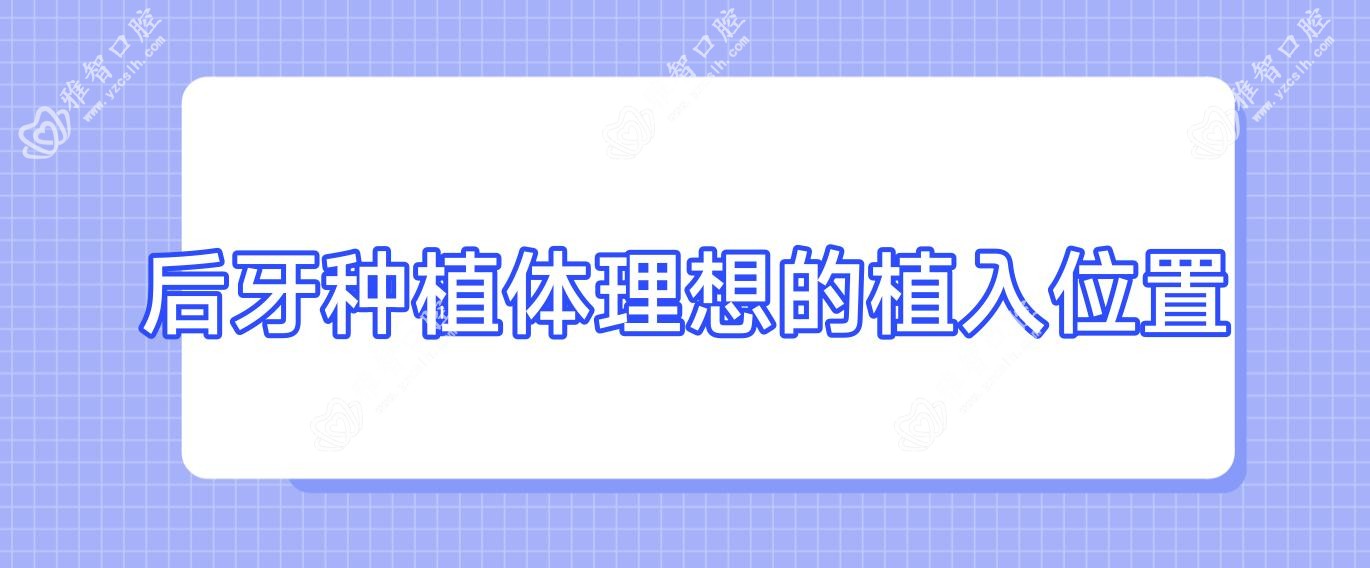 后牙种植体理想的植入位置