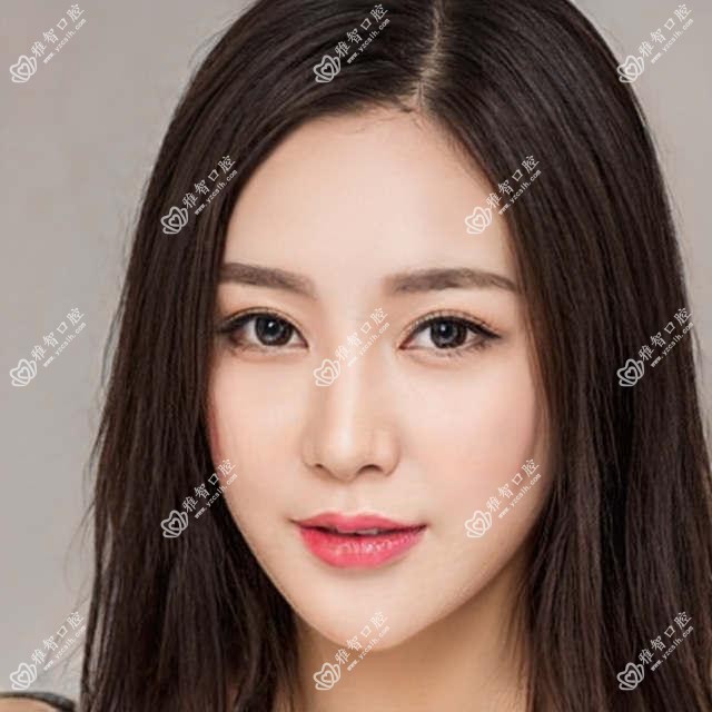 水晶牙钻的项目百科?水晶牙钻相关操作详细介绍?