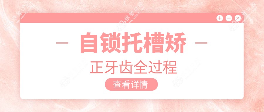 自锁托槽矫正牙齿全过程