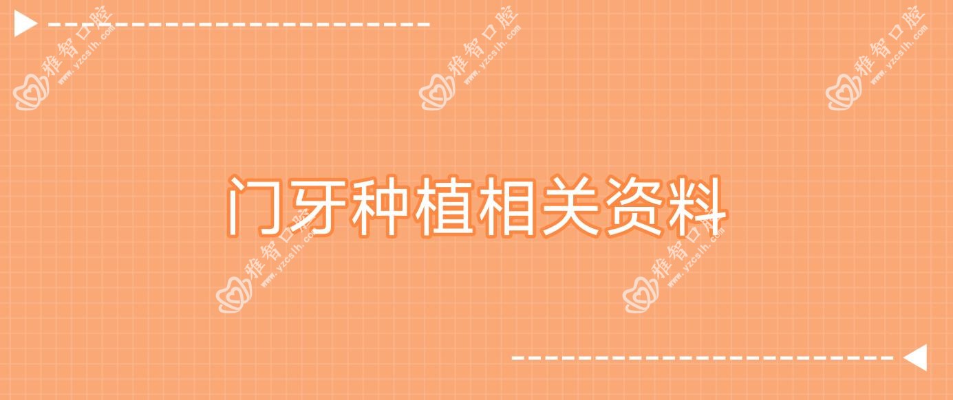 门牙种植相关资料