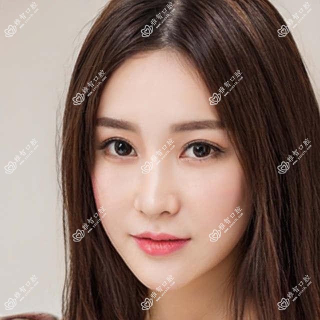 嘉兴偏颌正颌手术价目单,地址在嘉兴南湖区/嘉善县/海盐县偏颌正颌手术收费在136050-306780元