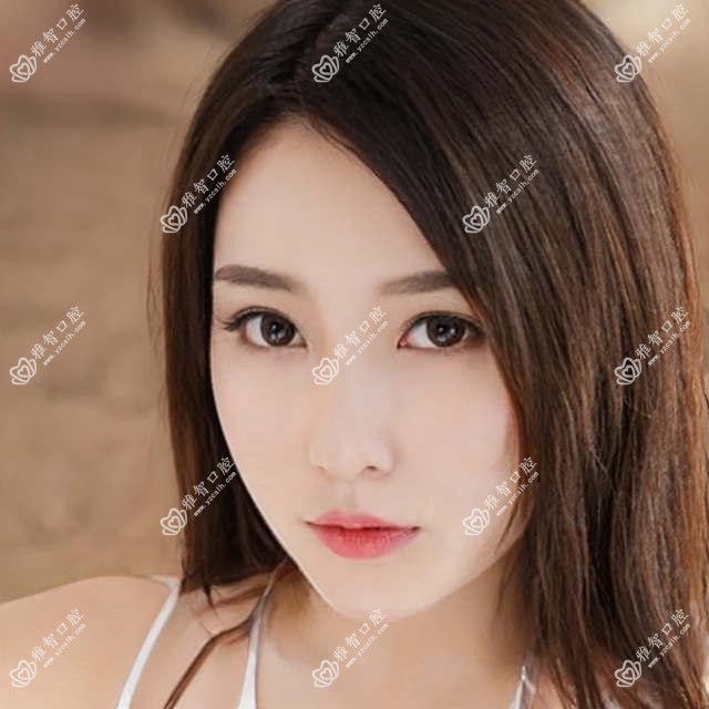 郑州皓齿美白价目单2025年较近发布,含四环素牙美白/牙齿抛光/变色牙美白价格明细