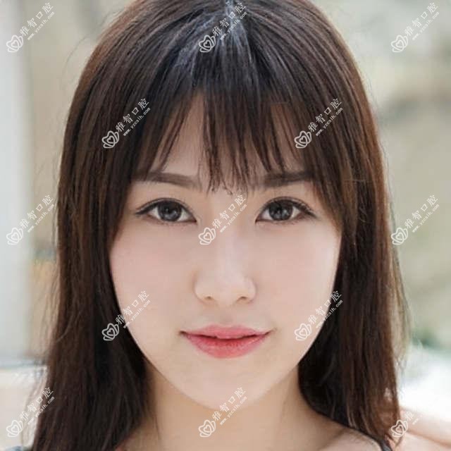 呼和浩特做洗牙多少钱?快看喷砂洁牙和超声波洁牙价目表