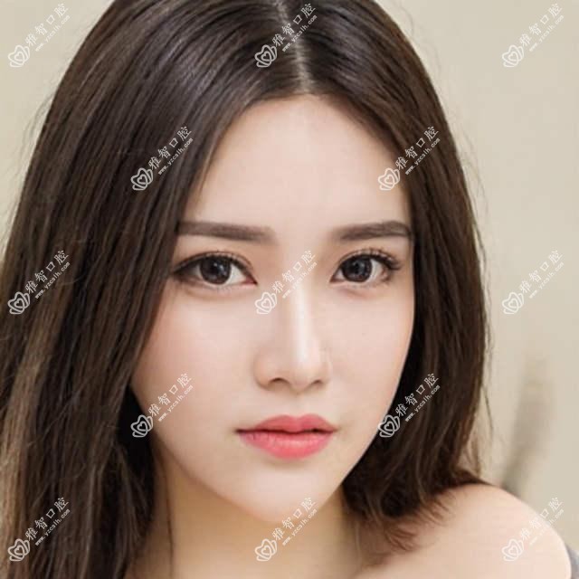 珠海龅牙牙齿矫正贵不贵?珠海下巴后缩牙齿矫正/龅牙牙齿矫正/深覆盖牙齿矫正价格便宜