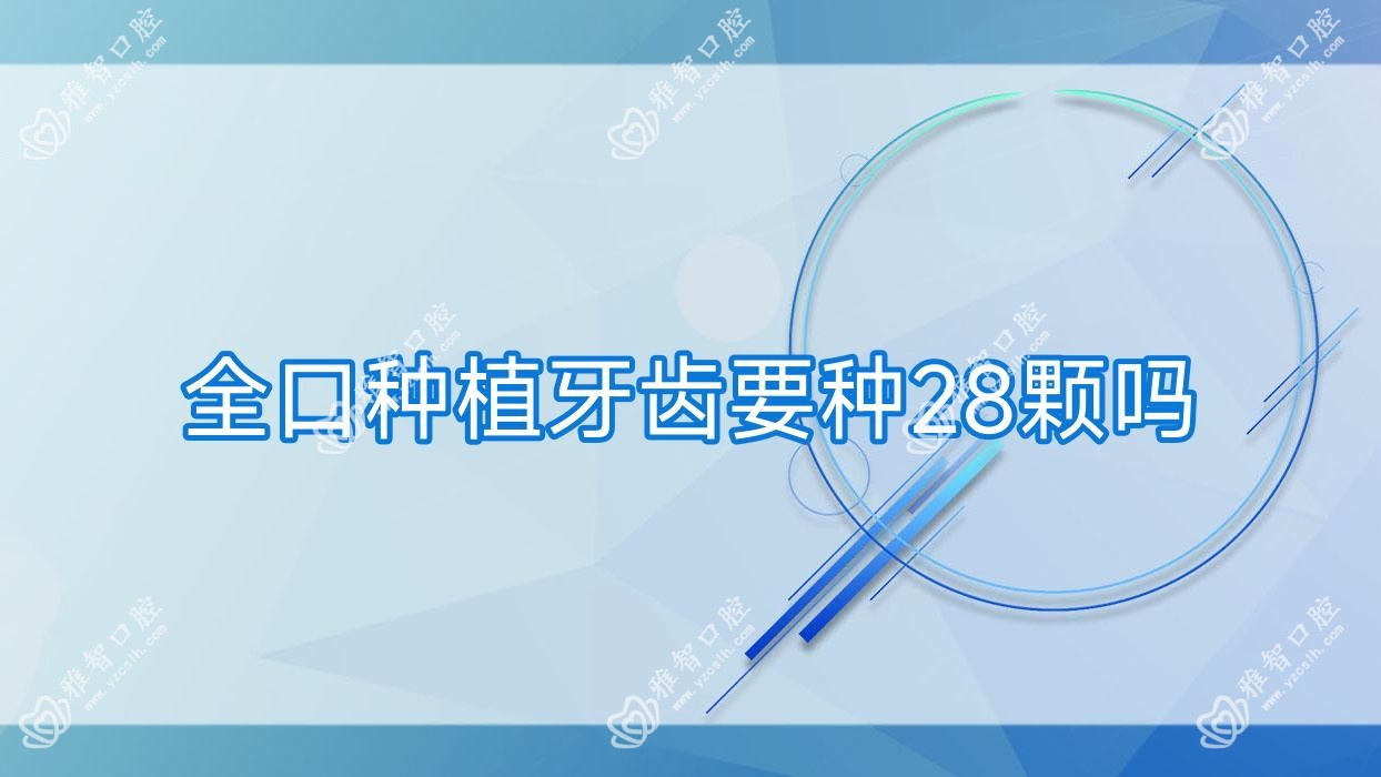 全口种植牙齿要种28颗吗
