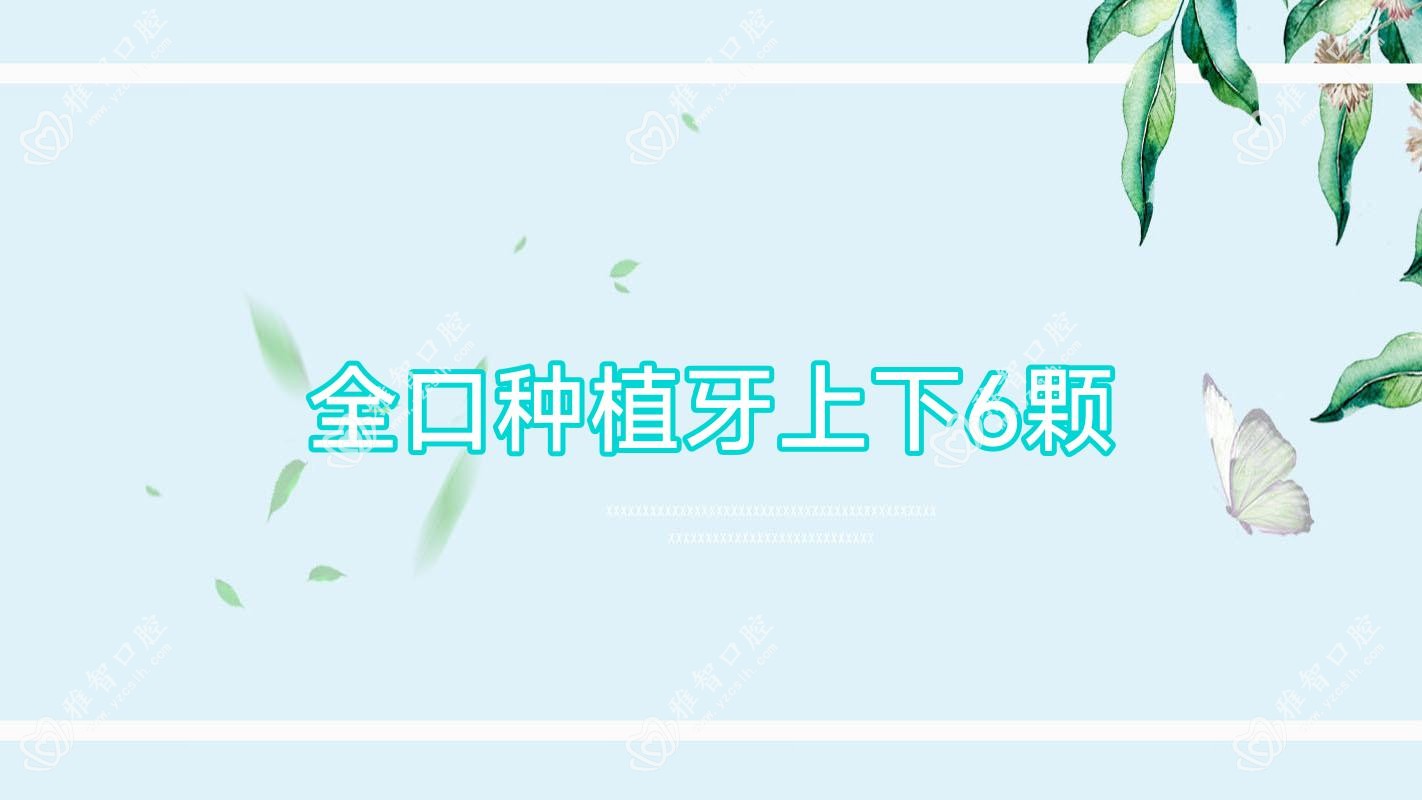 全口种植牙上下6颗
