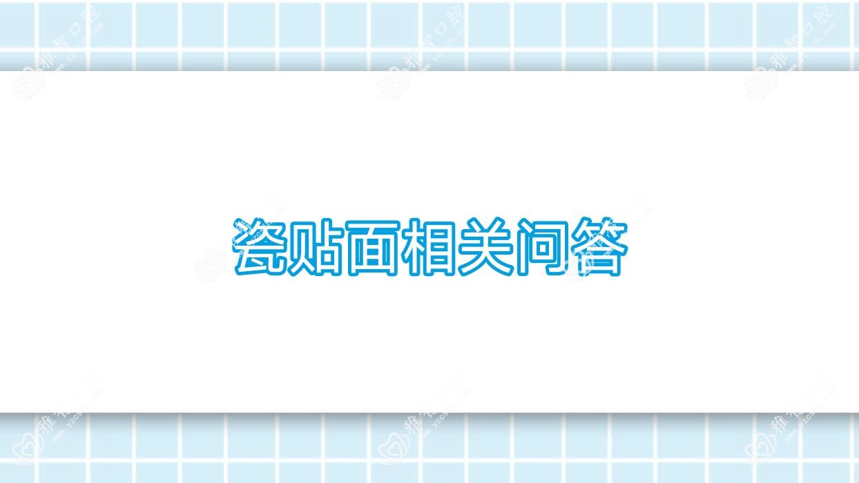 瓷贴面相关问答