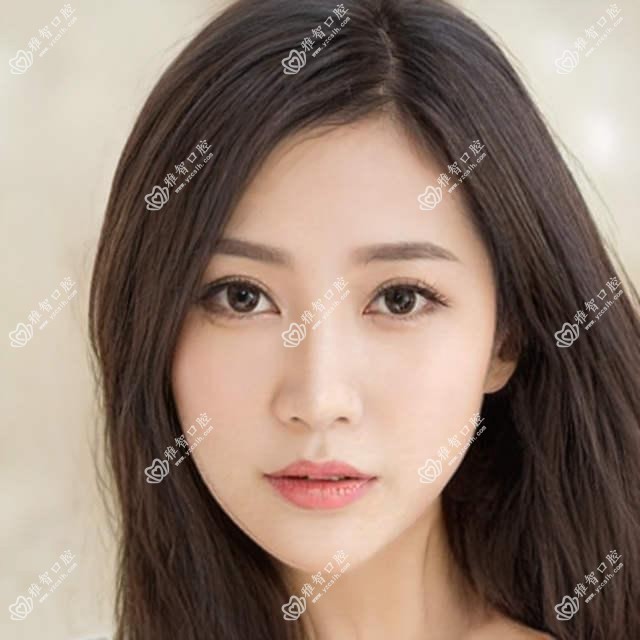 常德深覆合正颌手术大概需要多少钱?常德下巴后缩正颌手术/地包天正颌手术/龅牙正颌手术价格偏低