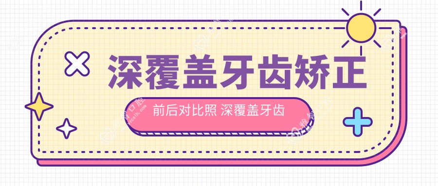 深覆盖牙齿矫正前后对比照 深覆盖牙齿矫正多少钱