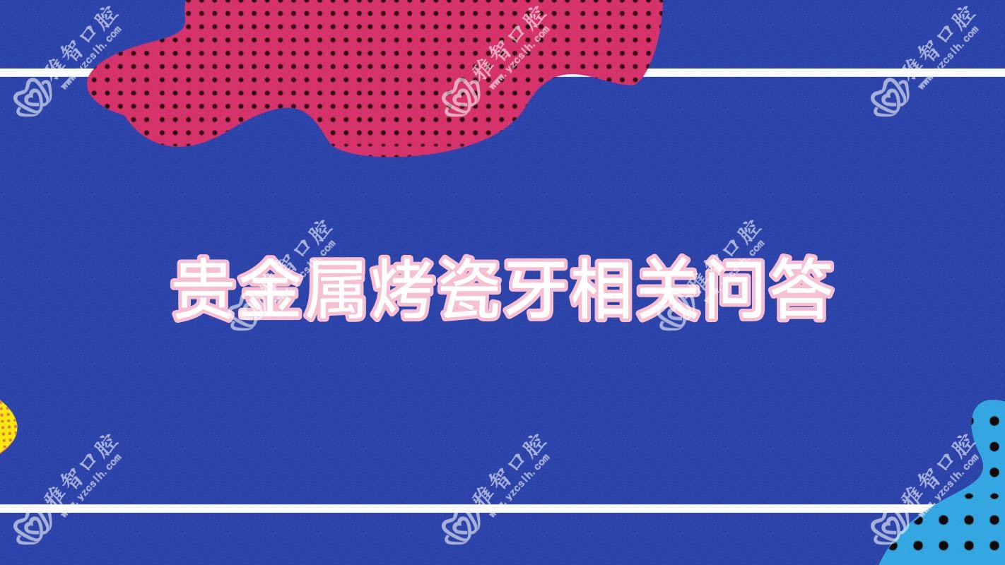 贵金属烤瓷牙相关问答