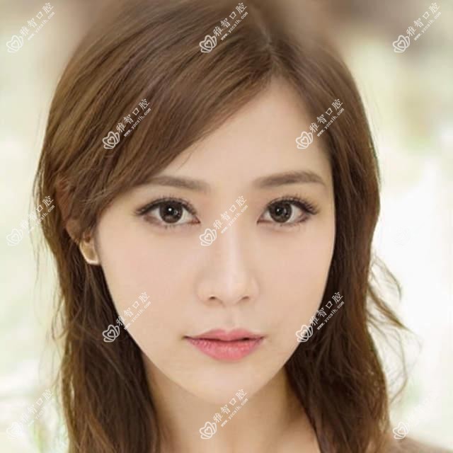 威高的项目百科?威高相关治疗优缺点以及禁忌人群?