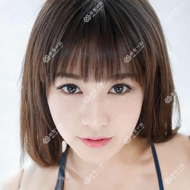 时代天使怎么治疗 时代天使好转方法详解