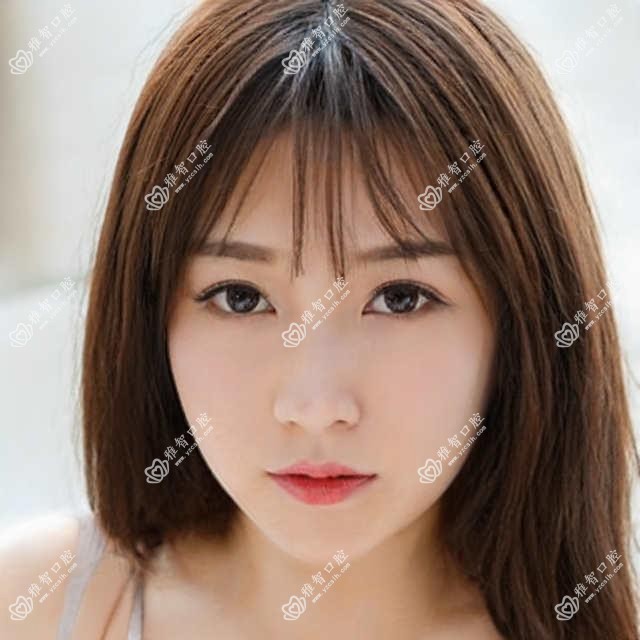 北京虎牙矫正/牙颌畸形价格明细预览表(2025北京虎牙矫正虎牙矫正均价为:15198元)