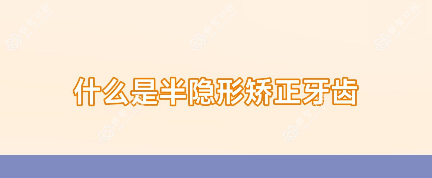 什么是半隐形矫正牙齿