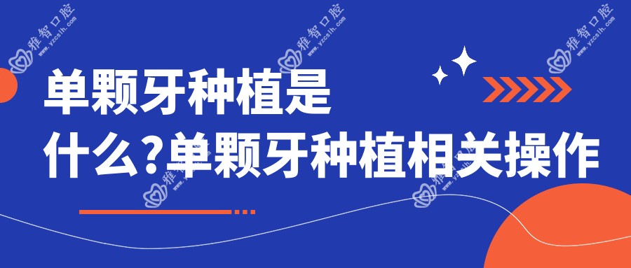 单颗牙种植是什么?单颗牙种植相关操作详细介绍?