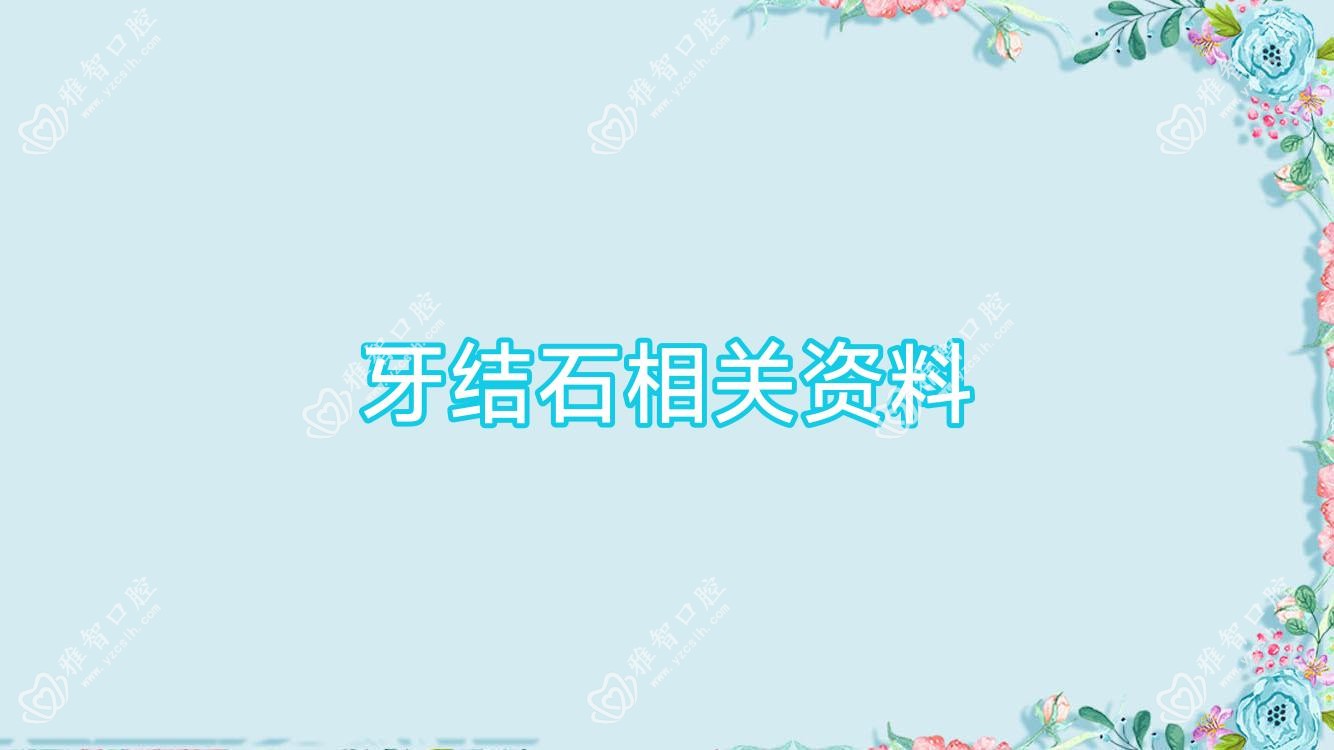 牙结石相关资料