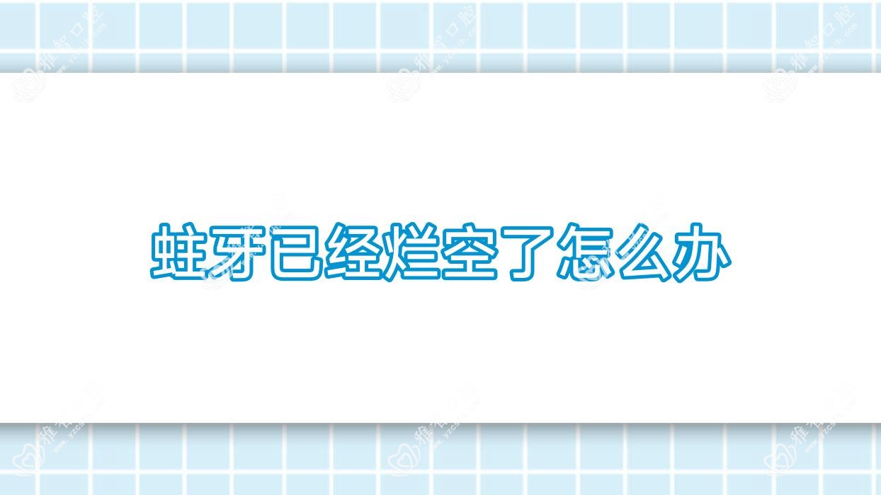 蛀牙已经烂空了怎么办