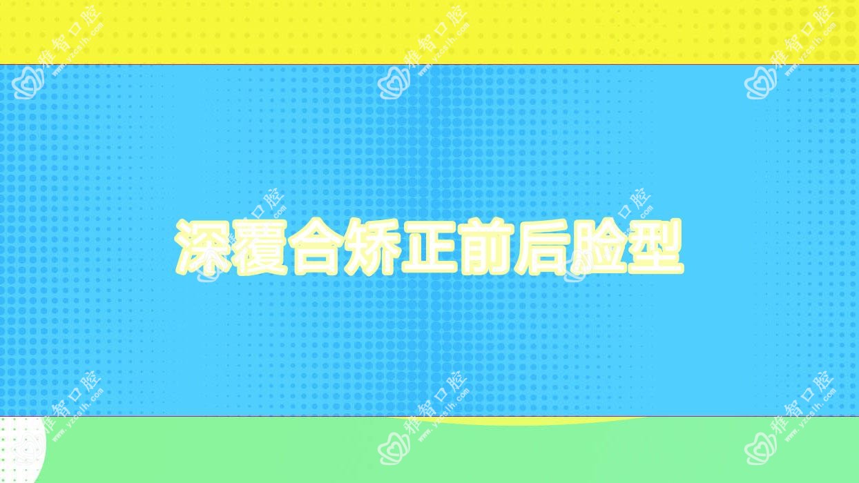 深覆合矫正前后脸型