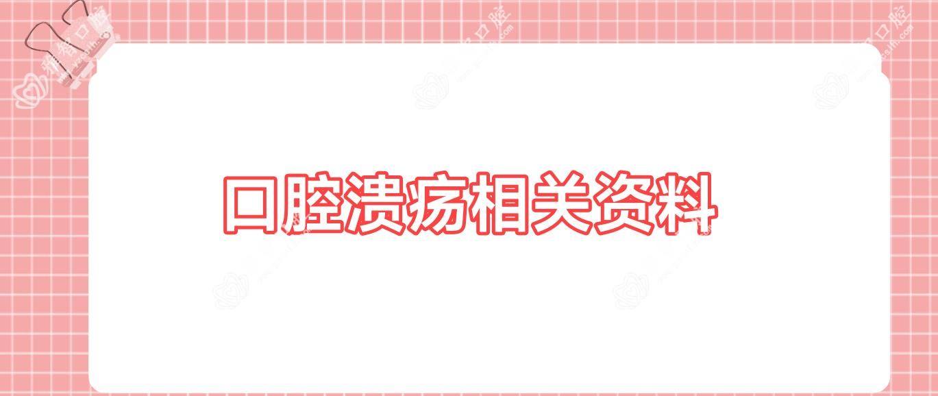 口腔溃疡相关资料