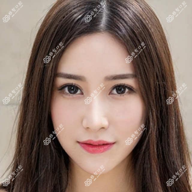 惠州单颗种植牙收费表明细超人气2025(近半年均价为:1650元)