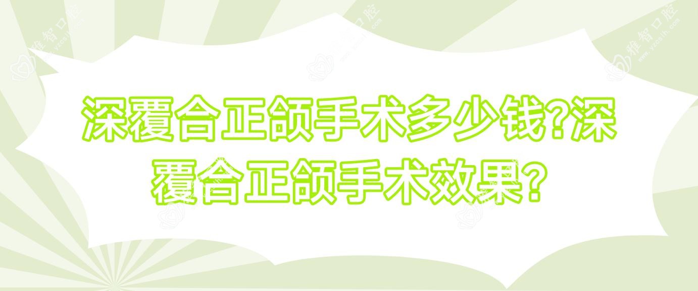 深覆合正颌手术多少钱?深覆合正颌手术疗效?