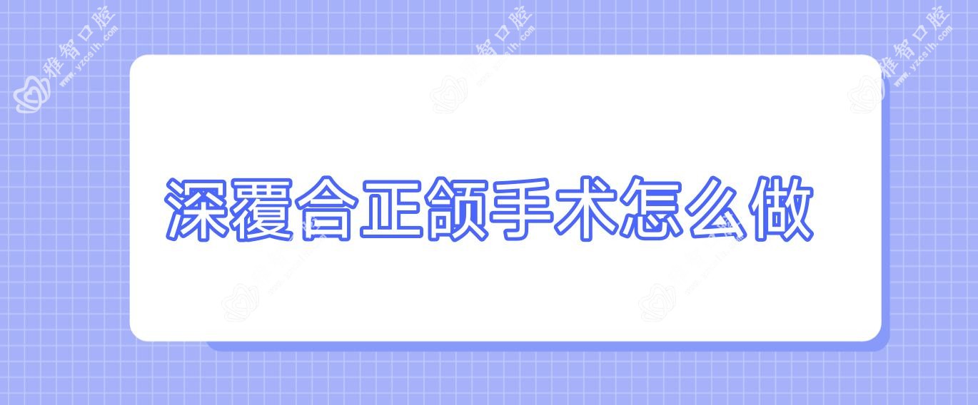 深覆合正颌手术怎么做