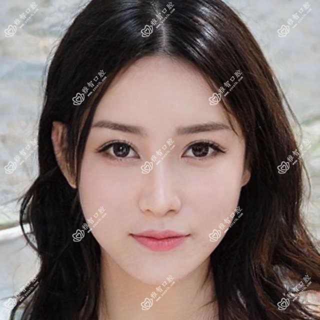佛山树脂贴面价格表2025(广州健业爱顿口腔门诊佛山禅城门诊部440元起/佛山禅城雅雄牙科480起)