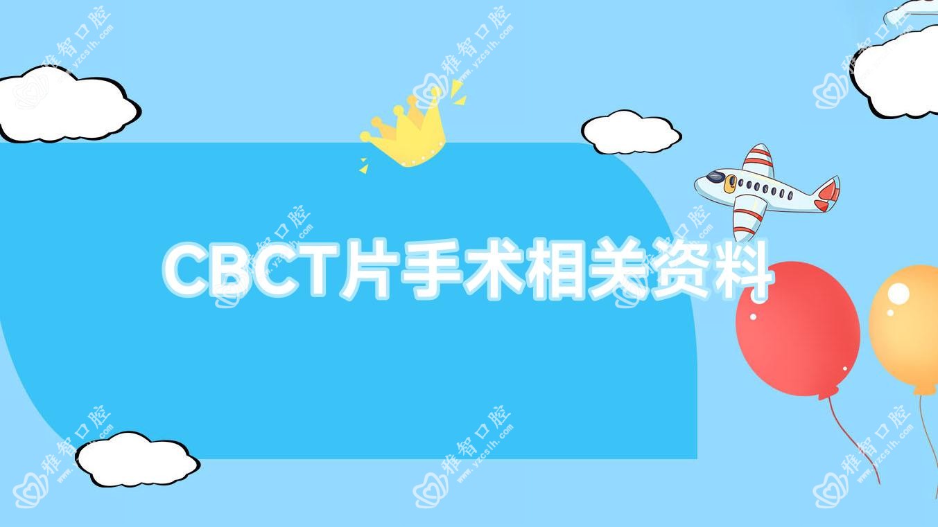 CBCT片手术相关资料