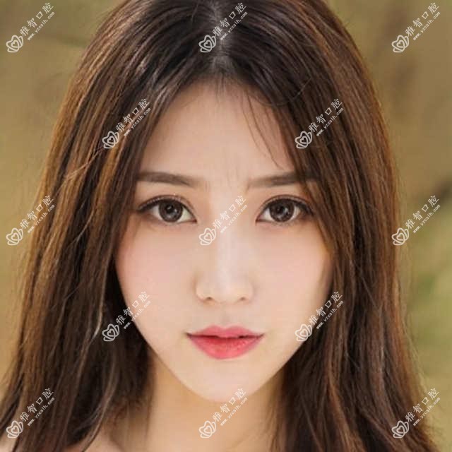 潍坊凸嘴牙齿矫正多少钱?2025价目表公开了~潍坊凸嘴牙齿矫正标准收费抓紧看!
