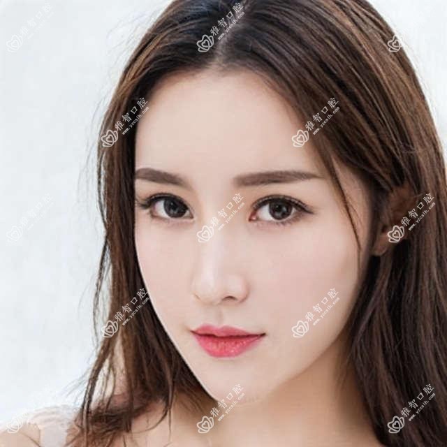 宁波做牙齿缺损修复多少钱?快点看烤瓷牙和树脂贴面收费表