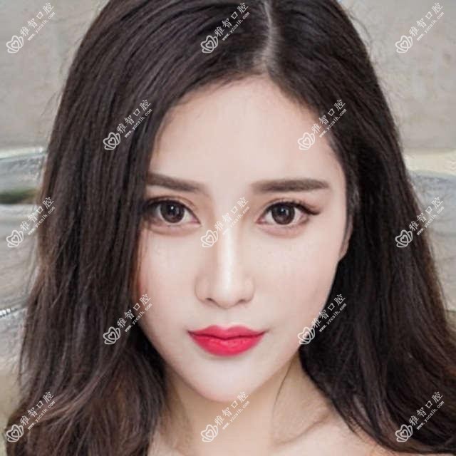 诺贝尔分析?诺贝尔好转方法详解?