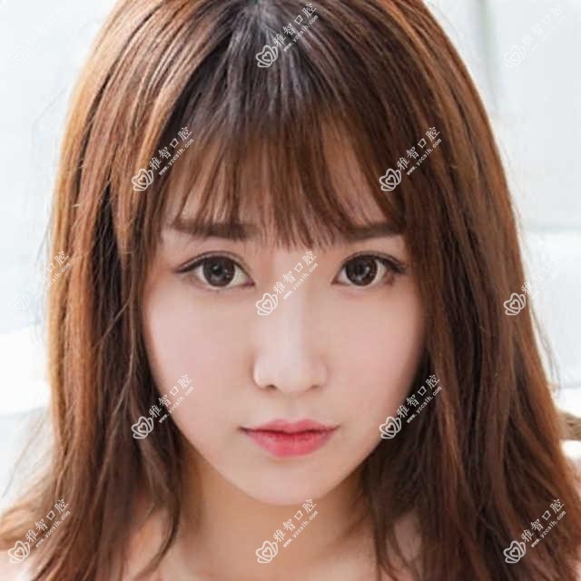 青岛喷砂洗牙收费明细2025新版,青岛喷砂洗牙/烟渍牙美白多少钱