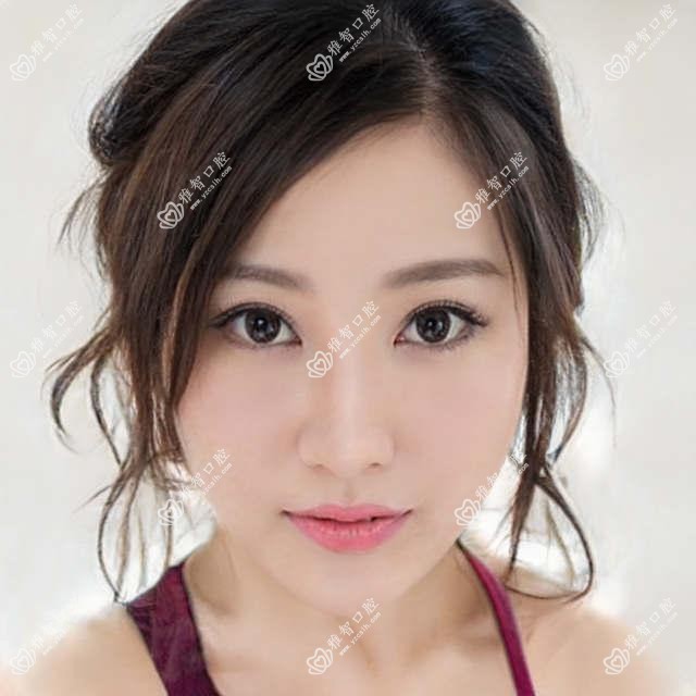 深圳百特康种植系统医院价目表(含深圳立世达特品牌口腔/深圳关莹口腔/同步齿科·中洲门诊(海岸城店) 百特康种植系统价格)