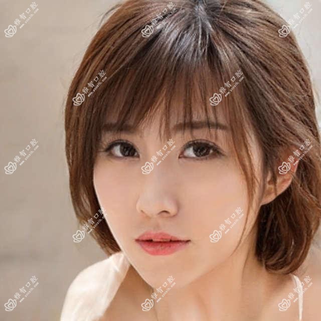 中山2025固定托槽矫正器收费表发布!(含隐形矫正器/舌侧矫正器价格价格表)
