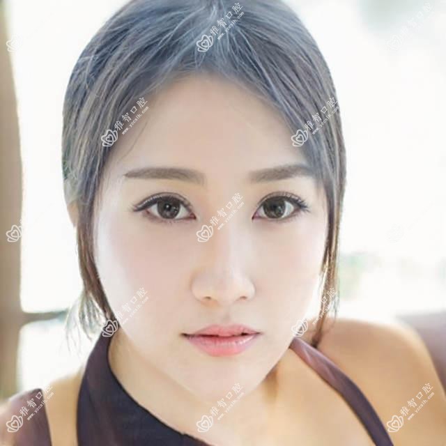佛山隐形矫正器多少钱?2025年详细隐形矫正器收费表