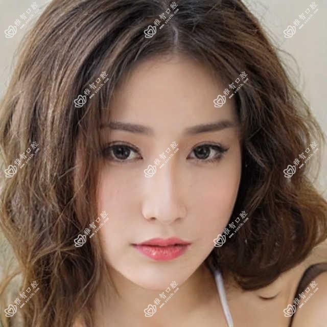 拔牙需要注意什么?拔牙相关操作详细介绍?