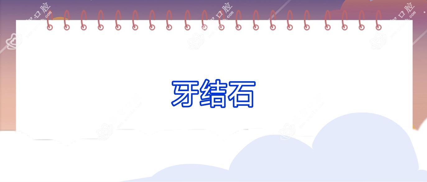牙结石