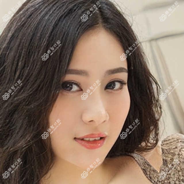 Zimmer分析?Zimmer治疗价格贵吗?