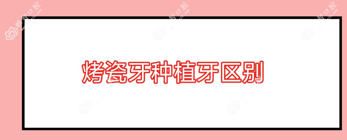烤瓷牙种植牙区别