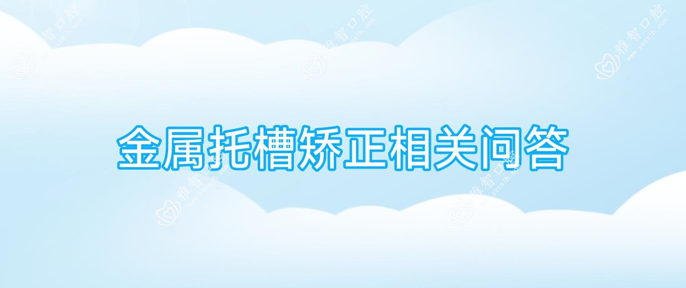 金属托槽矫正相关问答