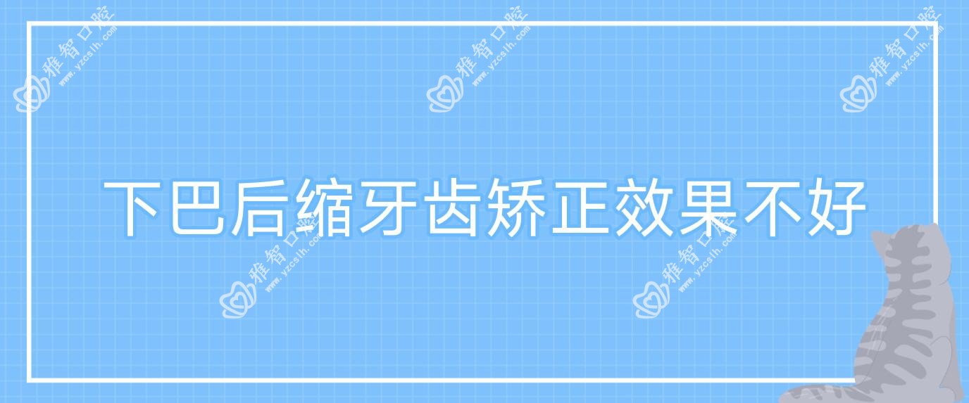 下巴后缩牙齿矫正疗效不好