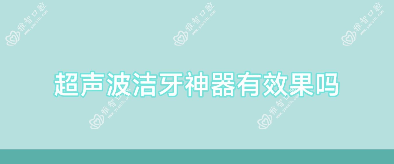 超声波洁牙神器有疗效吗