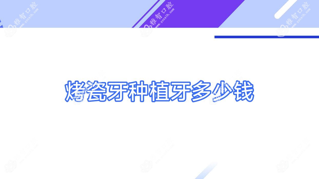 烤瓷牙种植牙多少钱