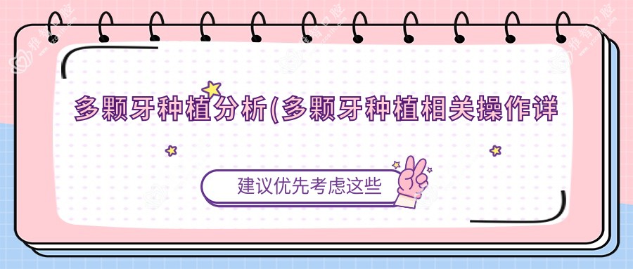 多颗牙种植分析(多颗牙种植相关操作详细介绍)